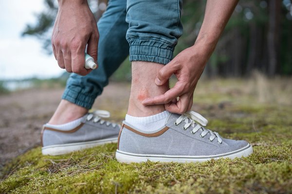 Eczéma nerveux : apaiser votre peau avec des solutions naturelles